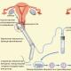 आईवीएफ के साथ लंबे समय से प्रतीक्षित गर्भावस्था का प्रोगिनोवा संरक्षण