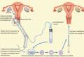 आईवीएफ के साथ लंबे समय से प्रतीक्षित गर्भावस्था का प्रोगिनोवा संरक्षण