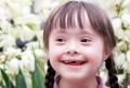 O osebah z Downovim sindromom: pričakovana življenjska doba, ali lahko imajo otroke